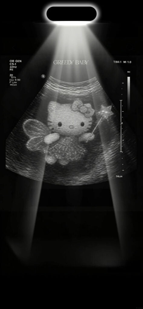 Ảnh Hello Kitty - 27